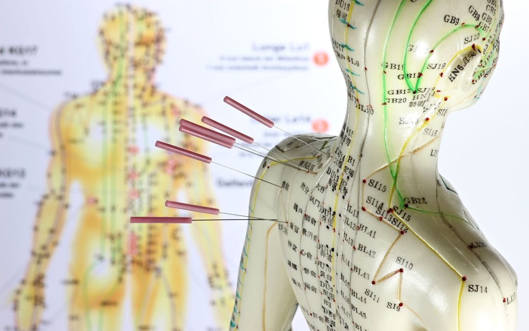 Acupuncture – Important Things You Need to Know about Pain