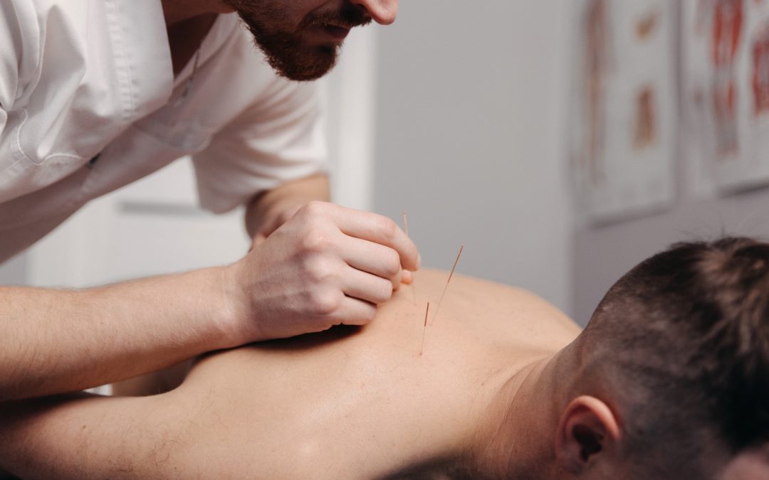 Acupuncturist placing a needle on the back of a man