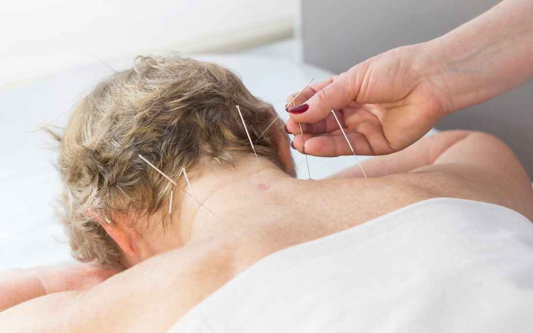 Elderly woman undergoing acupuncture procedure